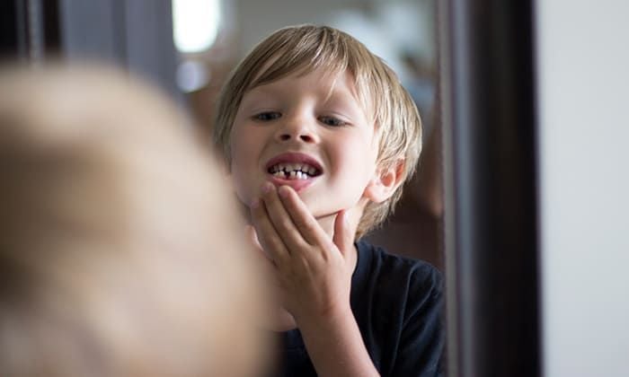 The Tooth Fairy’s Guide: How to Get Anti-Cavity Treatment Without Spending a Dime