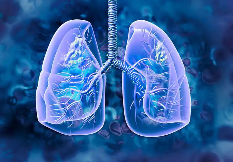 A Comprehensive Introduction to Lung Cancer
